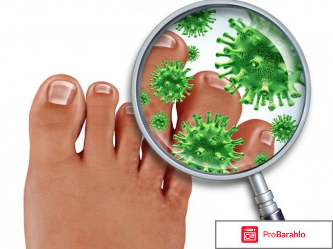 Стоп Актив от грибка 