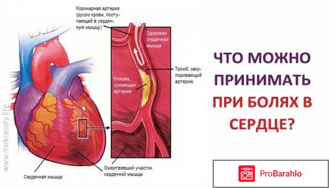 Если колет в области сердца что это значит отрицательные отзывы