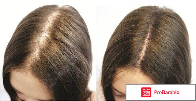 Генеролон спрей отзывы для женщин обман