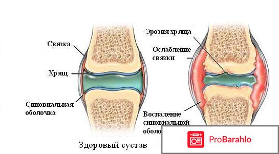 Лошадиный бальзам для суставов отзывы отрицательные отзывы