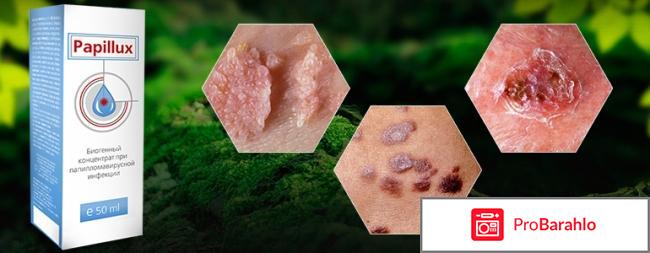 Papillux (Папиллюкс) против папиллом 