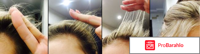 Алерана спрей против выпадения волос обман