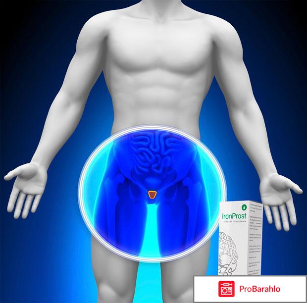 IronProst от простатита, АйронПрост отрицательные отзывы