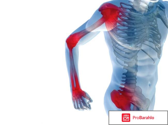 Артропант цена обман