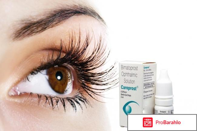 Bimatoprost ophthalmic solution careprost обман