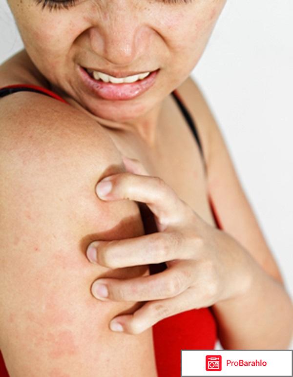 Переизбыток витамина с отрицательные отзывы