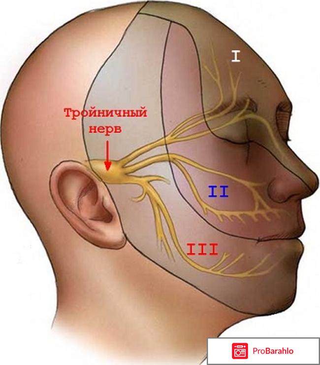 Неврит лицевого нерва отрицательные отзывы