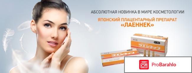 Лаеннек отзывы врачей 