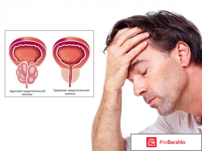 Афалаза отзывы врачей отрицательные отзывы