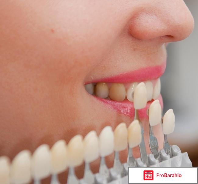 Виниры отзывы отрицательные реальные отзывы