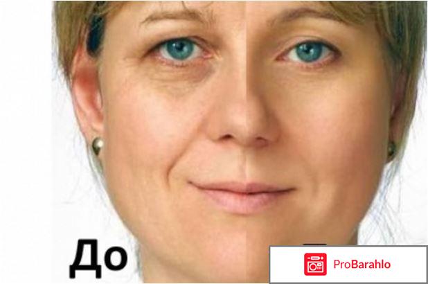 Коллагенарий противопоказания отрицательные отзывы