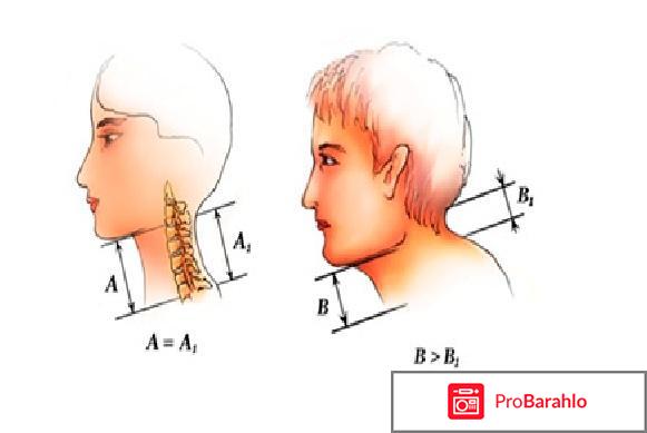 Меланет отзывы 