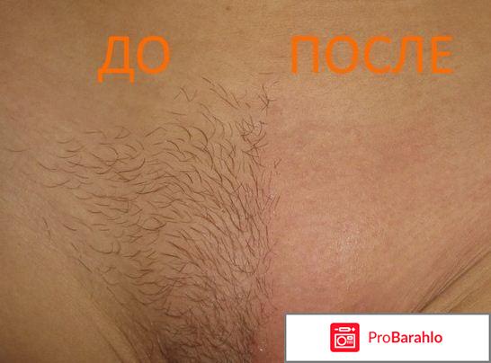 Для чего девушки бреют интимную зону наголо обман