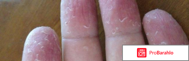 Деакура обман