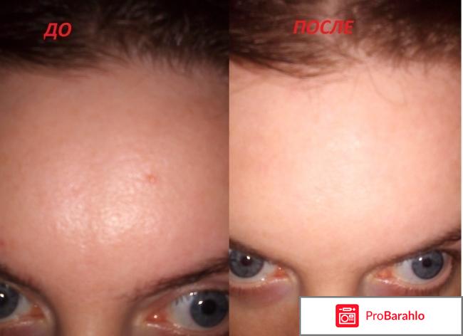 HYALU B5 концентрированная сыворотка с гиалуроновой кислотой обман