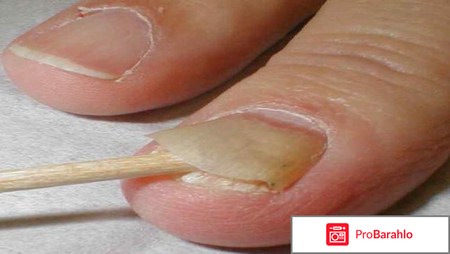 Tinedol (Тинедол) фото