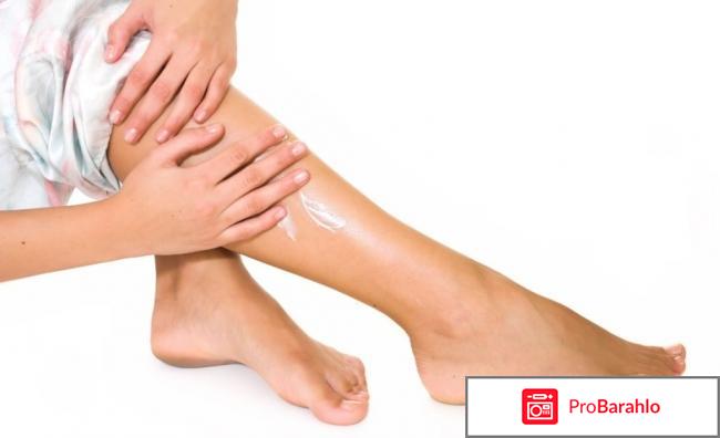 Гель вариус от варикоза цена обман