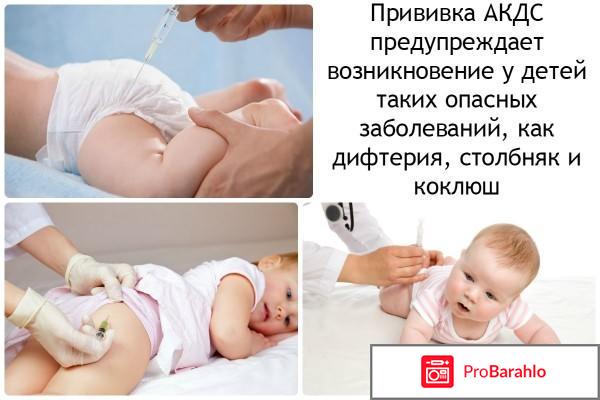 Прививка АКДС 