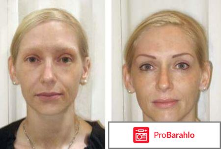 Межресничный татуаж отрицательные отзывы