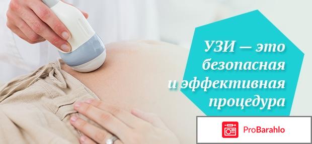 Узи оренбург отрицательные отзывы