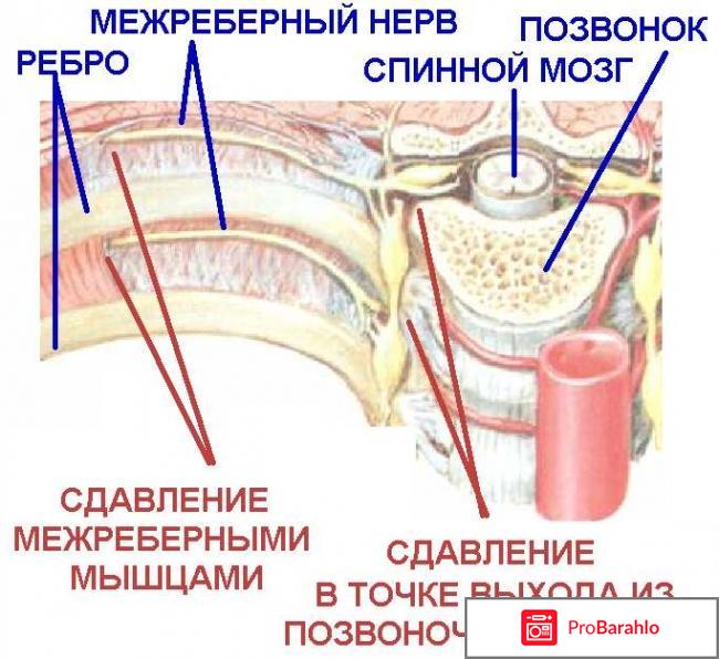 Почему при вдохе болит грудная клетка обман