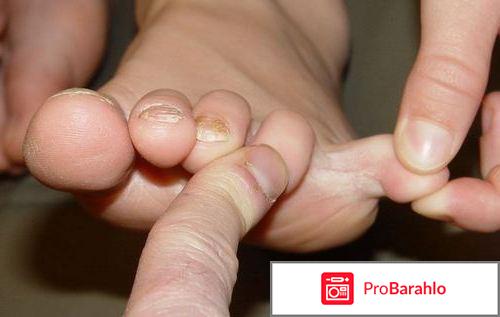 Экзомин (Exomin) фото