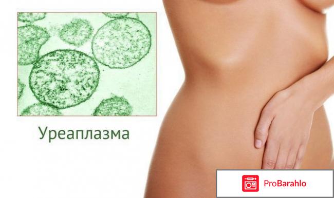 Уреаплазма у женщин отзывы 