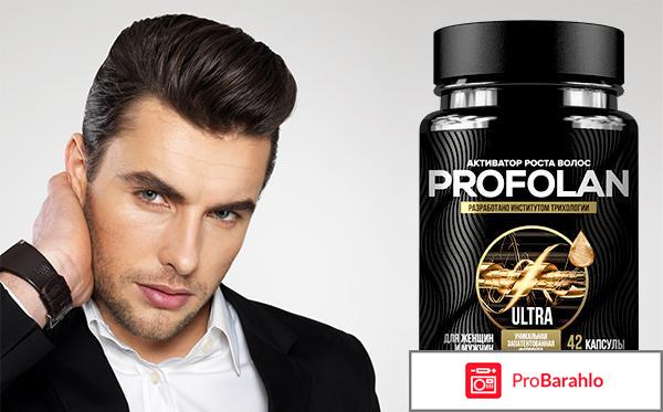 Лечение облысения отрицательные отзывы