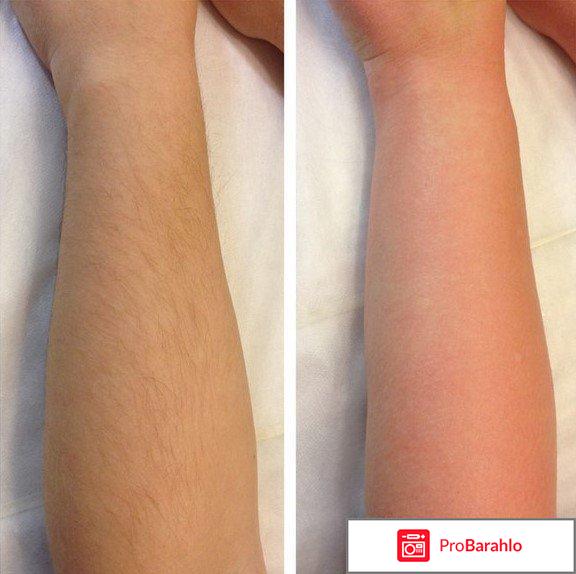 Depilation extra cream отзывы отрицательные отзывы