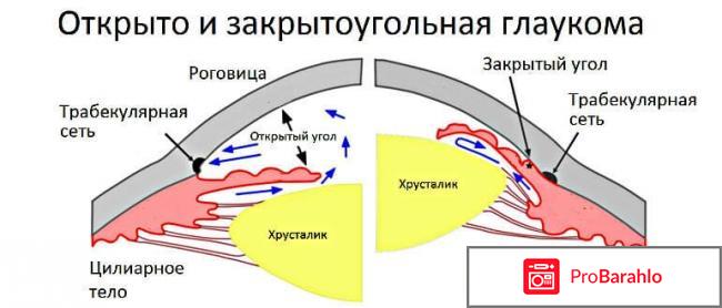 Трилактан глазные капли инструкция цена отзывы обман