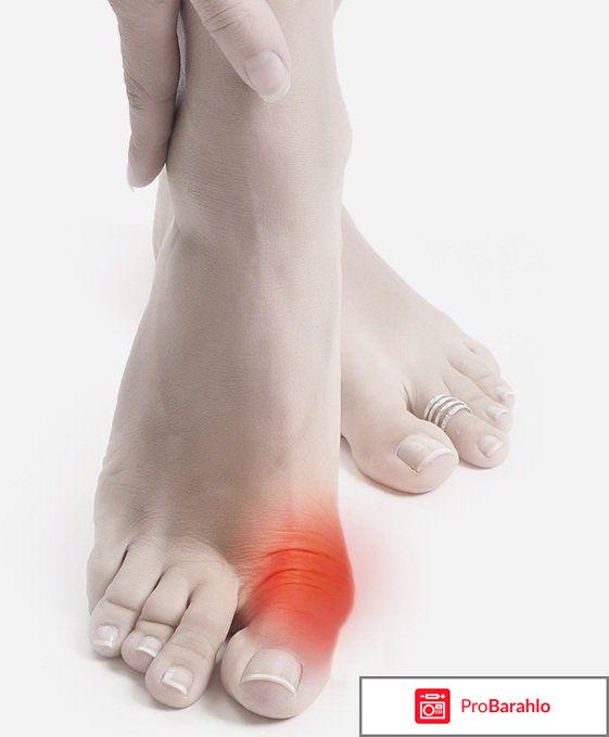 Фиксатор большого пальца valgus pro отзывы 