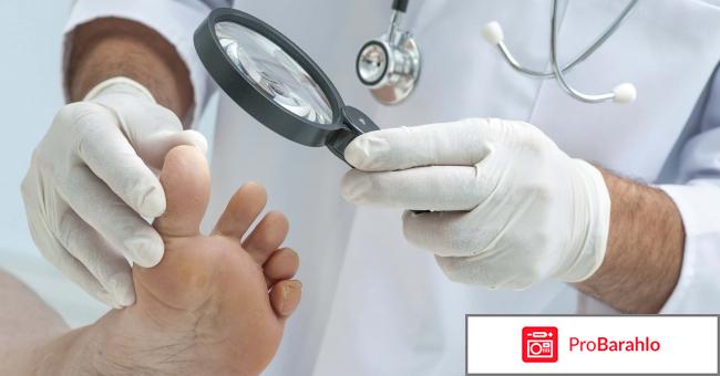 Серная мазь от грибка ногтей 