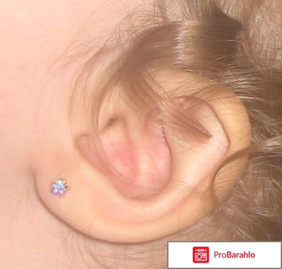 Проколоть уши ребенку в москве отрицательные отзывы