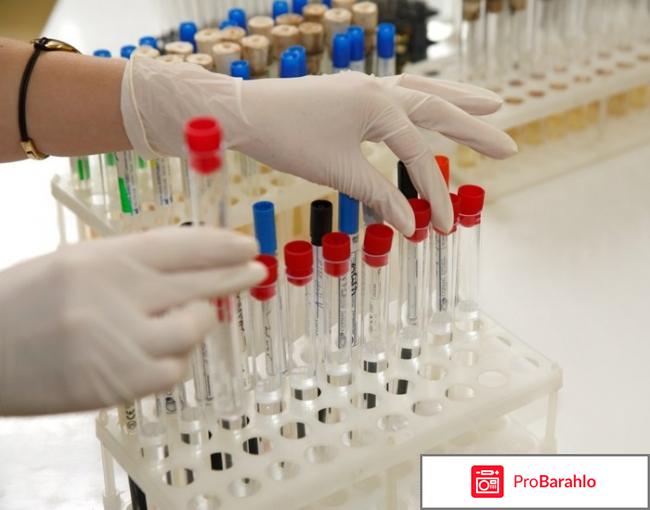 Подготовка к общему анализу крови 