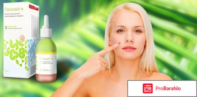 Папилайт (Papilight)