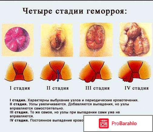 Проктология в москве отзывы отрицательные отзывы