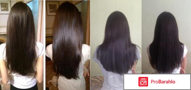 Селцинк отзывы для женщин при выпадении волос обман