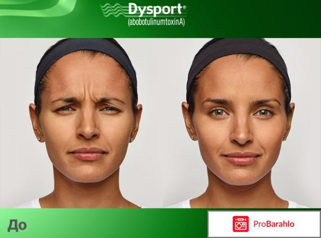 Цена диспорт обман