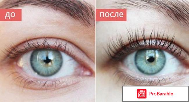 Almea Xlash Pro отрицательные отзывы