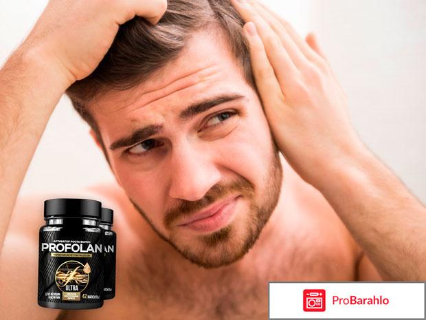 Profolan ? активатор роста волос: инструкция, цена отрицательные отзывы