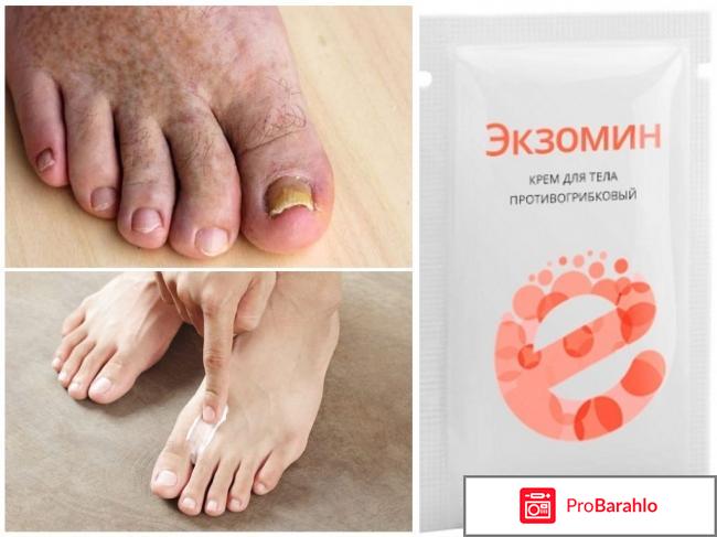 Экзомин (Exomin) фото