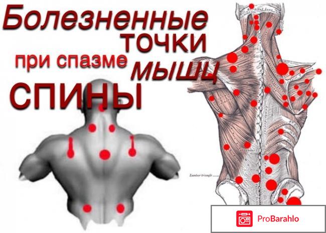 Сирдалуд инструкция по применению цена аналоги отрицательные отзывы