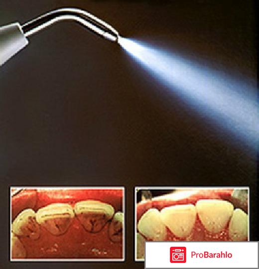 Чистка зубов пескоструем 