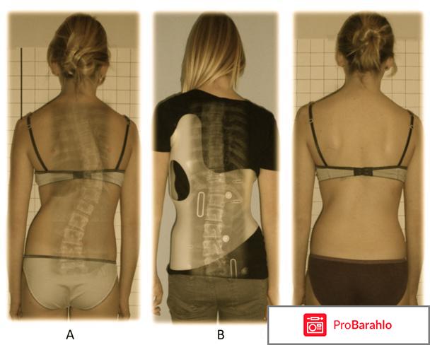 Корсет шено отрицательные отзывы обман