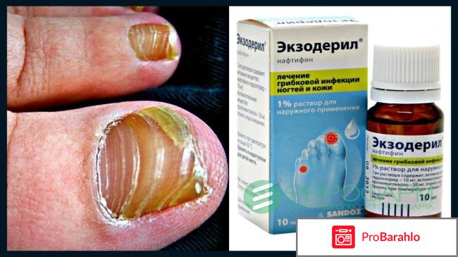 Экзодерил цена мазь аналоги дешевые отзывы обман