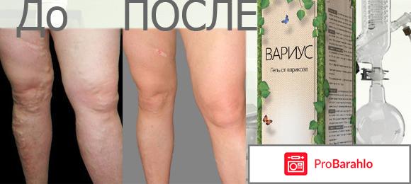 Вариус цена отрицательные отзывы