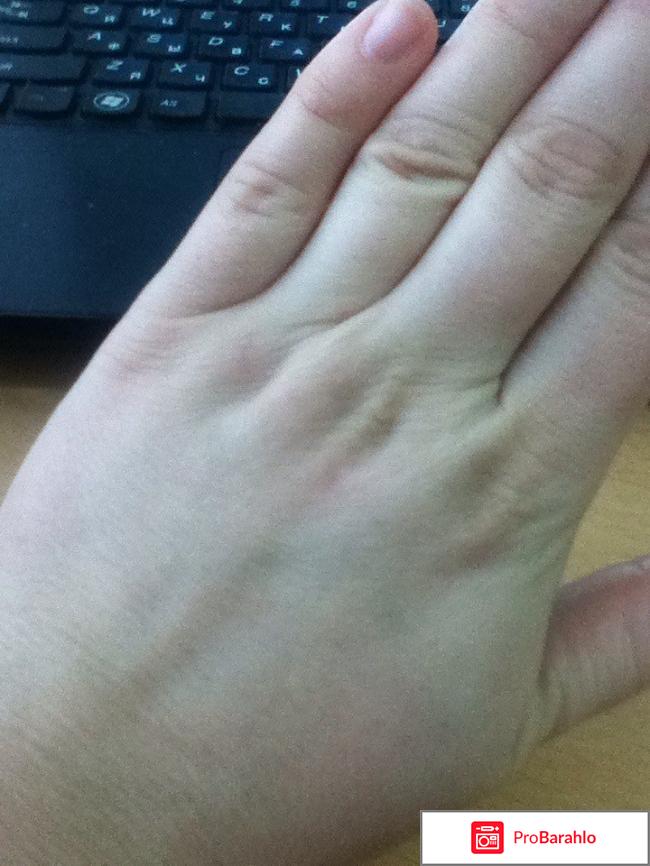 Ромашково-глицериновый отзывы владельцев