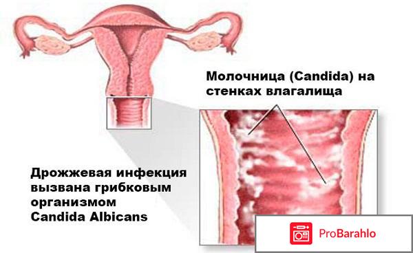 Ломексин отрицательные отзывы