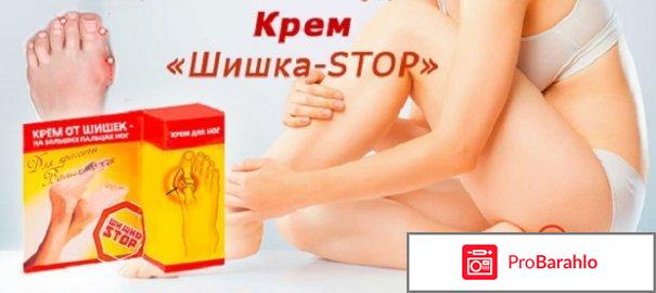 Крем `Шишка Стоп`: отзывы, цена, где купить обман