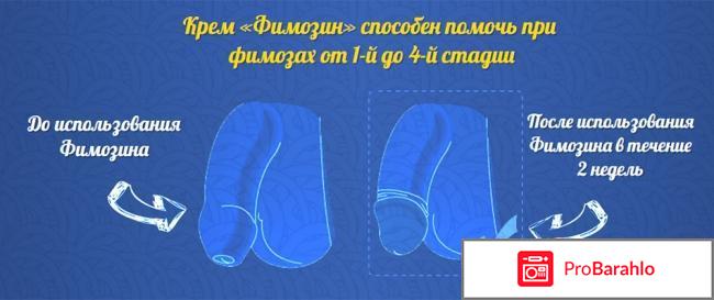 Фимозин цена отрицательные отзывы
